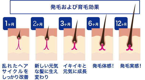 AGA薄毛の毛周期(ヘアサイクル)の事例