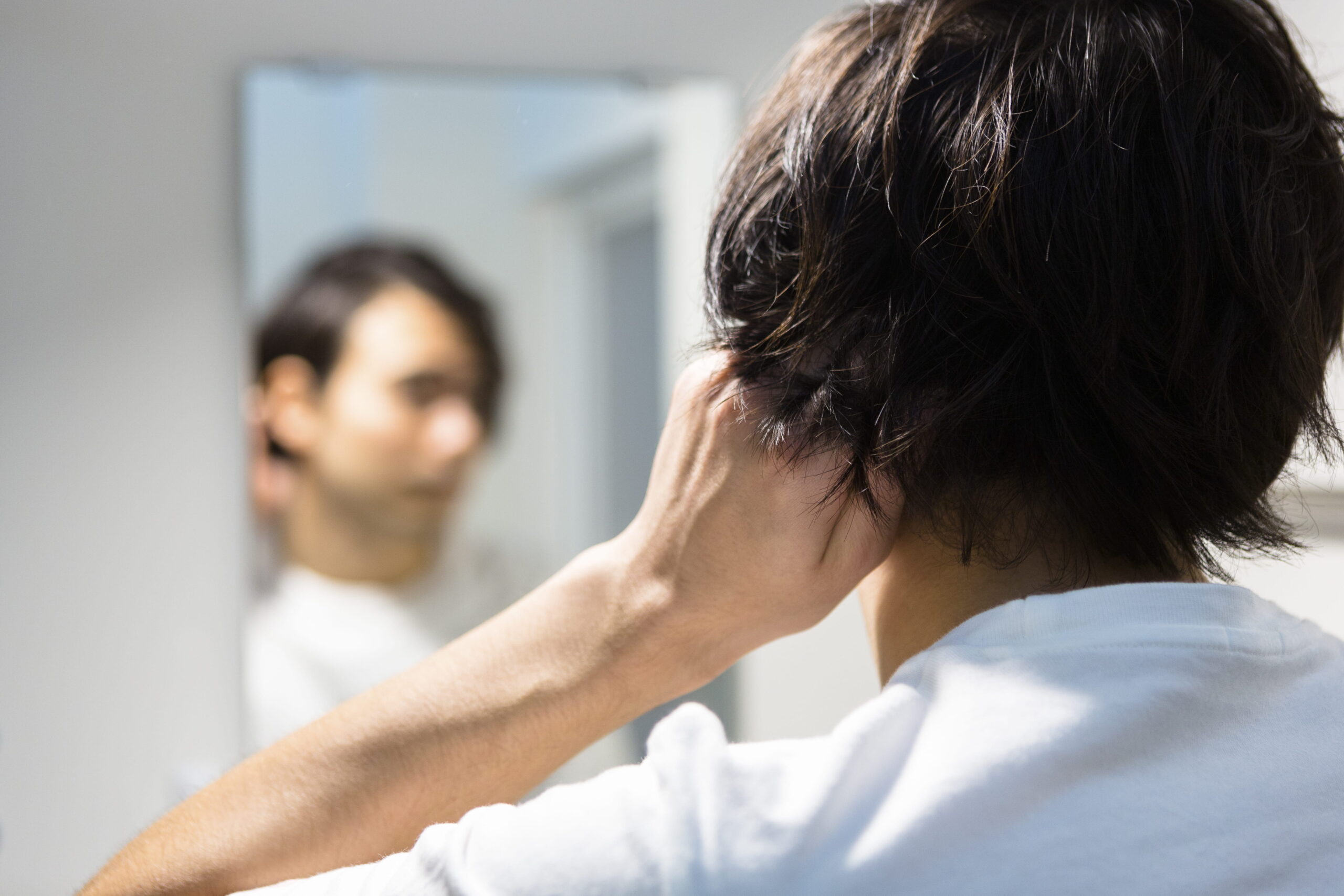 20代なのにハゲてきた！AGA治療はいつから始める？ | AGA・薄毛