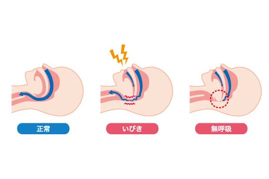 2.いびきの仕組みと原因